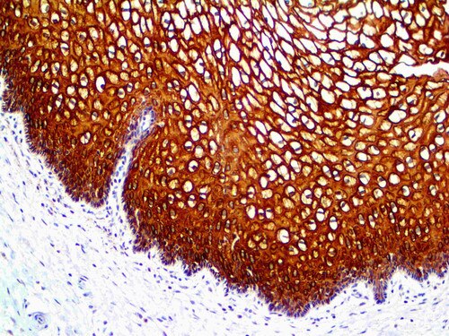 IHC of Cytokeratin 13 on an FFPE Cervix Tissue